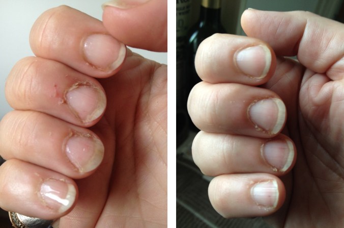 DR LEWIN week and half